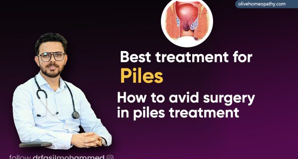 best treatment for piles
