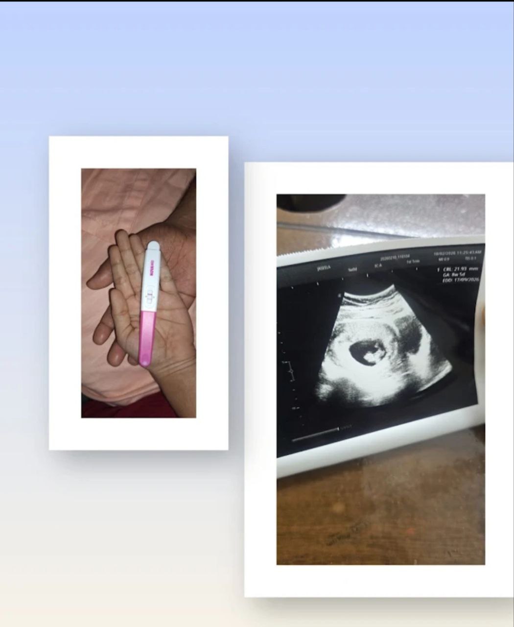 infertility success story olive homeropathy